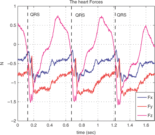 Figure 6. Correlation of the heart contact force with the ECG signal. [Color version available online.]