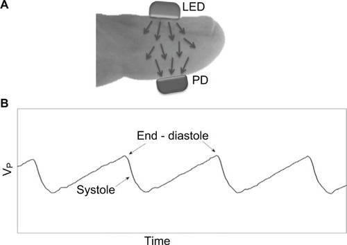 Figure 2 (A) The PPG probe. Light is transmitted from the light-source (LED) through the fingertip to the photodetector (PD). (B) Some pulses of the original PPG signal: the changes in transmitted light intensity as a function of time, due to cardiac activity. Maximal transmitted light intensity occurs at end diastole, when the tissue blood volume is at a minimum. Vp is the voltage pulses measured by the photodetector PD.