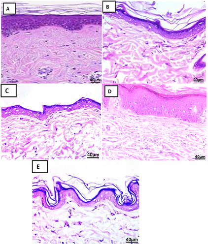 Figure 12 Photomicrographs of control skin sections of Group (I, II, III, IV&V) (H & E x 400) showing (A–E) with normal skin histological structural arrangement of dermis and epidermis.