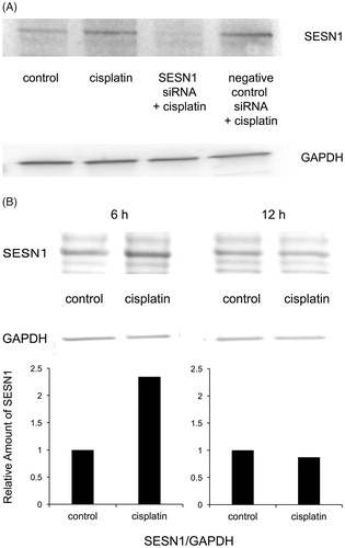 Figure 2. Western blot analyses of SESN1 in IMC-3CR cells. The protein expression of SESN1 was analysed by Western blotting in IMC-3CR cells (A) 3 h and (B) 6 or 12 h after treatment of cisplatin (1 μg/ml). GAPDH is used as a loading control. The blot density was quantified (lower panel).