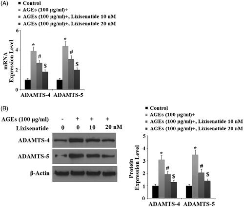 Figure 5. Lixisenatide ameliorates advanced glycation end products (AGEs)-induced expression of ADAMTS-4 and ADAMTS-5. (A) Expression of ADAMTS-4 and ADAMTS-5 were determined by real-time PCR analysis; (B) Expression of ADAMTS-4 and ADAMTS-5 were determined by western blot analysis (*, #, $, p < .01).