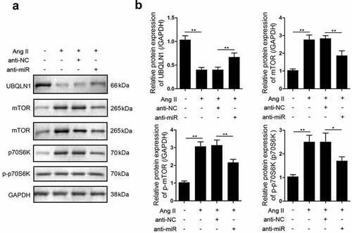 Figure 4. miR-337-5p regulates the expression of UBQLN1 and the downstream proteins. (a, b) Western blot assay was carried out to evaluate the expression levels of UBQLN1, mTOR, p-mTOR, p70s6k, and p-p70s6k (n = 3). *p < 0.05, **p < 0.01