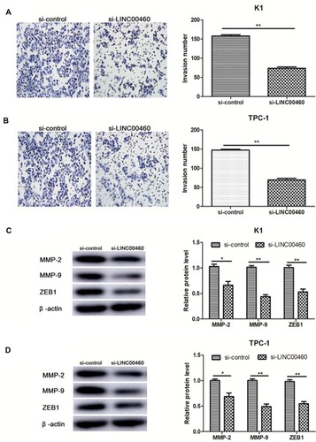 Figure 3 lncRNA LINC00460 knockdown inhibited the invasion of PTC cells. (A, B) The invaded cell quantity in PTC cell lines (K1, TPC-1) transfected with si-LINC00460 or si-NC was analyzed by Transwell invasive assay. (C, D) The protein expression of MMP-2, MMP-9 and ZEB1 was detected in PTC cell lines (K1, TPC-1) transfected with si-LINC00460 or si-NC by Western blot. *P<0.05, **P<0.01 vs control group.