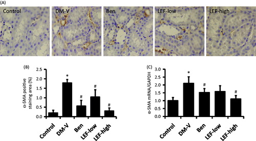 Figure 4. Renal α-SMA expression in diabetic rats treated with vehicle, benazepril or leflunomide for 8 weeks. (A) Representative images showing α-SMA staining in the kidney (Magnification = 400X). (B) α-SMA staining intensity quantified using ImageJ. (C) Renal α-SMA mRNA levels determined by real-time PCR. DM, diabetes mellitus group; V, vehicle; Ben, benazepril; LEF, leflunomide. Values are mean ± SEM; n = 8; *p < 0.05 versus control, #p < 0.05 versus vehicle-treated DM rats.