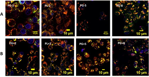 Figure 4. Confocal microscopy images of Calu-3 cells where nuclei labeled by DAPI/Blue and lysosomes labeled by LT-26/Green after incubation for 1 h with (0.5 mg/mL) NP-NRs/Red (A: all negatively-charged NPs and B: their positively-charged counterparts).