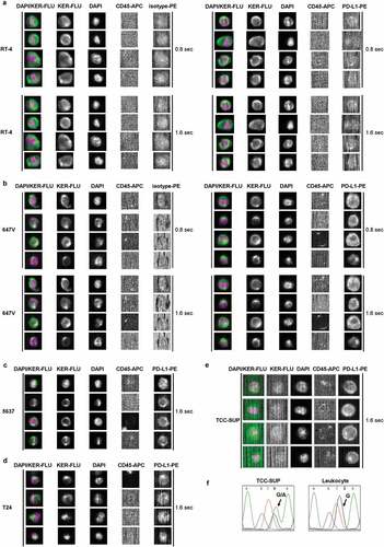 Figure 2. CellSearch® CXC kit analysis of UC cells spiked into the blood from healthy donors. Cells were enriched by anti-EpCAM magnetic beads using the CXC kit. Keratin+ (KER-FLU), CD45- (CD45-APC), DAPI+ cells were identified as tumor cells. (a) PD-L1 expression of RT-4 cells and (b) 647V cells were detected by the PE-conjugated anti-PD-L1 antibody clone E1L3N® (PD-L1-PE, right panel) in comparison to the isotype control clone DA1E (isotype-PE, left panel). Images of PD-L1-specific fluorescent signals were generated using the indicated exposure time. Furthermore, PD-L1 expression of (c) 5637, (d) T24 and (e) TCC-SUP cells were detected by the PE-conjugated anti-PD-L1 antibody clone E1L3N® (PD-L1-PE) using an exposure time of 1.6 sec. Identification of TCC-SUP cells was performed by manually evaluating fluorescent signals of stained cells in the CellSelect mode because of the low keratin expression impeding automatic selection. (f) TCC-SUP identity of the reported cells was confirmed by single-cell mutational analysis of the PIK3CA gene exon 9. Representative sequencing results showed a heterozygous mutation (G1633A) previously reported by Platt et al. Citation28 that was detected in a recovered single TCC-SUP cell but was absent in a leukocyte.