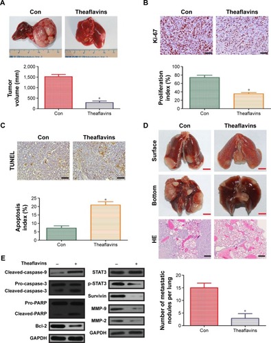 Figure 5 Theaflavins inhibit tumor growth and metastasis of HCC in vivo.