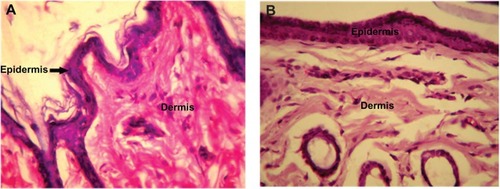 Figure 8 High intensity photomicrograph of a skin section from (A) a control animal and (B) an animal subcutaneously administered PLA-PEG nanoparticles.Abbreviations: PEG, poly(ethylene glycol); PLA, polylactic acid.