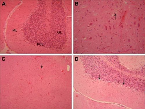 Figure 8 Histopathological effects of GONs on the brain of rats after 21 days. Representative photomicrograph of (A) control group (section of cerebellum, H&E, ×200), (B) Rats receiving 50 mg/kg of GONs (section of cerebrum, H&E, ×400), (C) Rats receiving 150 mg/kg of GONs (section of cerebrum, H&E, ×100), and (D) Rats receiving 500 mg/kg of GONs (section of cerebellum, H&E, ×100).Note: Black arrows indicate degenerated Purkinje cells in cerebellum; small black arrows indicate degenerated neuronal cells in cerebrum.Abbreviations: ML, molecular layer; PCL, Purkinje cell layer; GL, granular layer; GONs, graphene oxide nanoplatelets; H&E, hematoxylin and eosin.