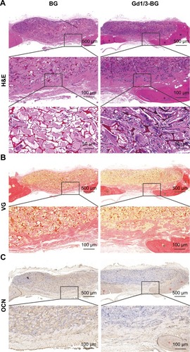 Figure 7 Histological analysis of cranial bone defects.Notes: (A) H&E, (B) VG, and (C) immunohistochemical staining of OCN in the defects implanted with Gd-BG and BG scaffolds at 8 weeks after implantation. Black stars indicate new bone formation. Green star indicates new collagen formation, and red stars indicate positive staining of OCN.Abbreviation: Gd-BG, gadolinium-doped bioglass; VG, Van Gieson’s.