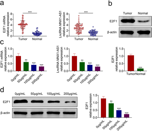 Figure 3. AcRoots reduced expression of E2F1 and MNX1-AS1.