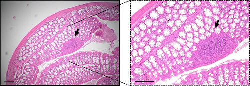 Figure 6. Representative photomicrograph of hematoxylin and eosin (H&E) staining in distal colon. Staining was performed in 5 μm sections from paraffin embedded colon from a C57Bl/6J mouse 20 weeks age fed with chow diet. GALT structure is marked with an arrow. Scale = 100 μm.