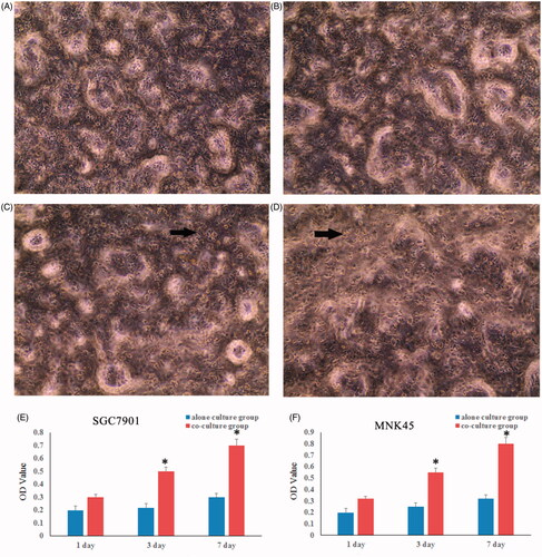 Figure 2. The gastric cancer cells grew faster when co-cultured with TAFs. The proliferation of SGC7901 (A) and MNK45 (B) cells were tested by alamarBlue assay at 1, 3 and 7 d of culture. There was a significant increase in the viability of gastric cancer cells at 3 and 7 d of co-cultured with TAFs.