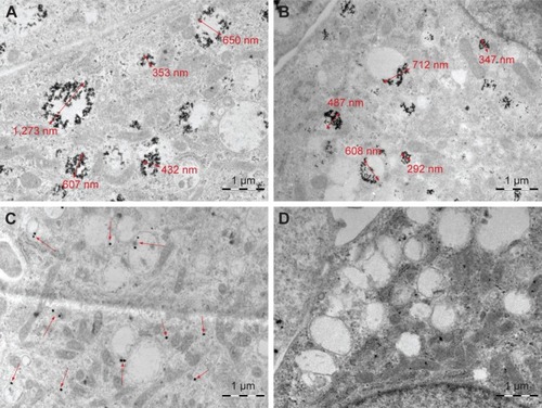 Figure 4 TEM images of U87 cells.Notes: 20 nm iron NP clusters (A); 20 nm gold NP clusters (B); 50 nm gold NPs (C); and a control image without NP (D).Abbreviations: TEM, transmission electron microscopy; NP, nanoparticle.