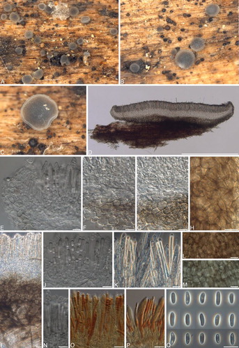 Fig. 7 Phialocephala catenospora. A–C. Apothecia on fallen decaying Betula papyrifera branch. D. Vertical section of apothecium. E. Vertical section of apothecial margin. F, G. Ectal and medullary excipulum. H. Ectal excipulum cells. I. Vertical section of apothecium with subicular hyphae in host tissue. J. Refractive vacuole bodies of paraphyses under DIC. K. Refractive vacuole bodies of paraphyses under phase contrast. L. Ectal excipulum cells mounted in H2O. M. Ectal excipulum cells in KOH. N. Asci. O–P. Asci with hemiamyloid tips in Lugol’s solution after KOH pretreatment. Q. Ascospores. Bars = 10 μm.