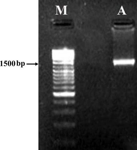 Figure 3 Electrophoresis of the resultant amplicon in 1% agarose gel.Notes: (A) 16S rDNA amplified using PCR from the genomic DNA of Desertifilum sp. (M) Molecular marker .