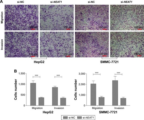 Figure 3 Knocking down NEAT1 inhibited the migration and invasion of the hepatocellular carcinoma cell lines HepG2 and SMMC-7721.