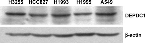 Figure 1 DEPDC1 expression levels in lung cancer cell lines. DEPDC1 is expressed in all the lung cancer cell lines tested, and expression levels in H3255 and A549 cells are higher than in the remaining cell lines.