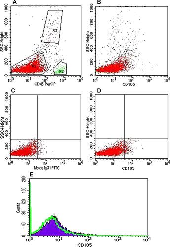 Figure 2 Flow cytometry of analysis of CD105 negative case. (A) Dot plot showed gating using CD45/SSC strategy, blast cells (R1), normal lymphocytes (R2) and granulocytes (R3). (B) Scatter dot plot showing blast cells, normal lymphocytes and granulocytes all negative for CD105 expression. (C) Dot plot showing the mouse IgG1 isotypic negative control. (D) Dot plot showing negative CD105 expression on gated blast cells. (E) Histogram showing negative CD105 (solid violet curve) versus negative control (green colored curve).