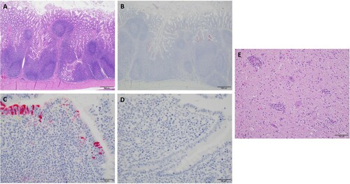 Figure 4. Analysis of sections of intestine and brain of infected and control pigs by H&E and IHC. A) H & E stain with prominent lymphoid follicular development in an infected pig (Scale bar, 500 μm). B) IHC for MRV with strong positive staining of follicular associated epithelium (FAE) and underlying lymphoid tissue in an infected pig. No staining noted in lymphoid follicles proper (Scale bar, 500 μm). C) The image represents segments of FAE overlying lymphoid follicles in the terminal ileum of an infected pig. Staining was consistently present on the lower lateral aspect of the FAE with mild staining in the lamina propria between the epithelium and underlying lymphoid follicle proper (Scale bar, 50 μm). D) The image represents segments of FAE overlying lymphoid follicles in the terminal ileum of in a control pig (Scale bar, 50 μm). E) H & E stain of the section from base of cerebellum inoculated pig #20. Prominent perivascular cuffs of lymphocytes, macrophage-like cells, and rare plasma cells. There is mild diffuse gliosis. In other areas, distinct foci of gliosis are prominent (Scale bar, 100 μm).