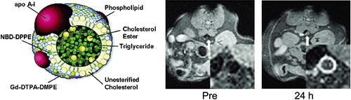 Figure 6. Illustration of quantitative‘magnetic resonance immunohistochemistry’ with the fibrin‐targeted perfluorocarbon nanoparticles in the case of an ex vivo human carotid endarterectomy sample: (a) An optical image of a 5‐mm cross‐section of a human carotid endarterectomy sample. This section showed moderate luminal narrowing as well as several atherosclerotic lesions. (b) A 19F projection image acquired at 4.7 T through the entire carotid artery sample shows high signal along the lumen due to nanoparticles bound to fibrin. (c) A concentration map of bound nanoparticles in the carotid sample. (With permission from Morawski et al. 2004 Citation58.)