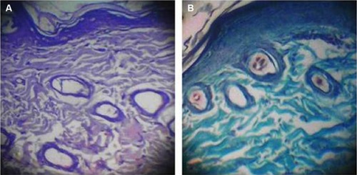 Figure 9 Histological examination at a magnification power of 100× of a section in normal rat skin.Notes: Stained with hematoxylin and eosin (A) and Masson’s trichrome (B).