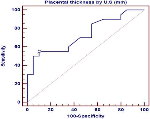 Figure 3 ROC curve of placental thickness by ultrasound as a predictor of placenta accreta spectrum.