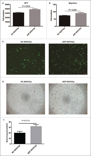 Figure 3. Overexpressed AEP in human SKOV3ip cells and the proliferative ability changed. (A) The cell numbers of AEP-SKOV3ip cells was increased faster as compared with NC-SKOV3ip cells by MTT assay. (B) The cell numbers of AEP-SKOV3ip cells was more than NC-SKOV3ip cells by migration assay. (C) Migration capacity of AEP-SKOV3ip cells was performed using transwell assay. (D) The supernatant of AEP-SKOV3ip cells could increase the tube forming capacity of HUVECs by tube formation assay. (E) Grapical illustration of the AEP-SKOV3ip cells on the branching points of the capillary-like structures in HUVECs. Scale bar, 100µm.