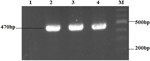 Figure 2 Electrophoresis results of SRY gene amplification. Land 1: Negative control; Land 2: Positive control; Land 3: Affected child sample; Land 4: Embryo A1 sample; Land (M) Ladder 100bp.