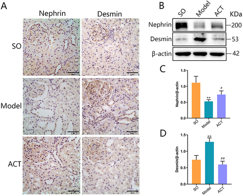 Figure 9 ACT attenuated podocyte injury in DKD rats. (A) Immunohistochemistry staining of nephrin and desmin (400× magnification). (B) Representative Western blots showing the detection of nephrin and desmin. (C) Relative protein expression of nephrin. (C) Relative protein expression of desmin. expression of desmin. Data are expressed as mean ± SD, n =5. **P<0.01 vs sham-operated (SO) group; #P<0.05 and ##P<0.01 vs model (Model) group.