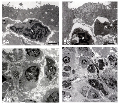 Figure 5 Electron micrographs of nodular lymphoid tissue at 1 month (A and B) and 3 months (C and D) after Staphylococcus aureus inoculation. (A) Polymorphonuclear leukocytes (P) were situated beneath the flattened follicle-associated epithelium, which contained microvilli (arrows). Bar = 2 μm. (B) The center of the follicle was occupied by densely packed lymphocytes (L) and plasma cells (PC). Bar = 2 μm. (C) At 3 months after inoculation, the follicle-associated epithelium contained numerous secretory granules, each with an electron-dense core. Bar = 2 μm. (D) PC and P were present in the center of the follicle. A dendritic cell (DC) was adjacent to the inflammatory cells. Bar = 2 μm.