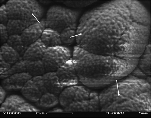 Figure 6 Cryogenic scanning electron microscope image of Process B (double-pass homogenization at 96.53 MPa with no preheating) soymilk, the arrows show that though the particles are separated, they are unhydrated with rough surface and not having uniform particle size. These larger particles may be fat globules coalesced and are not completely absorbed in the protein matrix.