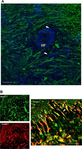 Figure 2 MAGP-1 protein localization in young skin.