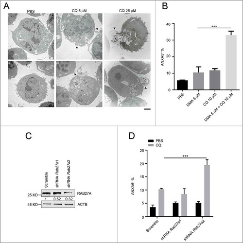 Figure 8. The anti-leukemic activity of chloroquine is enhanced by exocytosis inhibition. (A) MA9 leukemia cells were treated with chloroquine at 5 μM for 2 h or at 25 μM for 6 h followed by TEM analysis. Scale bar: 2 μm. (B) Chloroquine and DMA combinatory treatment at the indicated dosages for 24 h followed by ANXA5 and 7-AAD staining for apoptosis analysis by flow cytometry. Results are mean ± SD, *** P < 0.001 (n = 6 repeats). (C) MA9 leukemia cells transduced with scramble or Rab27a shRNA were harvested after 48 h of puromycin selection for western blot analysis. Numbers represent the densitometry quantification of protein levels normalized to ACTB. (D) MA9 cells described in (C) were treated with chloroquine at 10 μM for 24 h followed by ANXA5 and 7-AAD staining for apoptotic analysis.