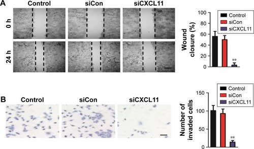 Figure 3 CXCL11 knocked-down inhibits SW480 cells migration and invasion.