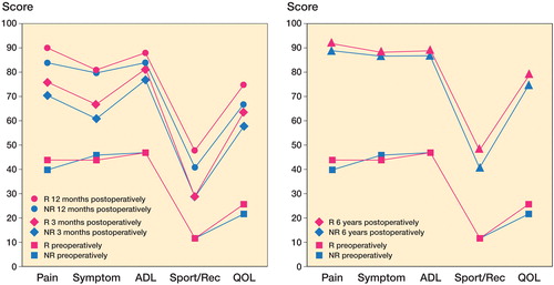 Figure 2. KOOS subscales (with 0 meaning worst and 100 meaning best) preoperatively and 3 and 12 months postoperatively (left panel) and properatively and 6 years postoperatively (right panel). R: resurfacing: NR: no resurfacing.