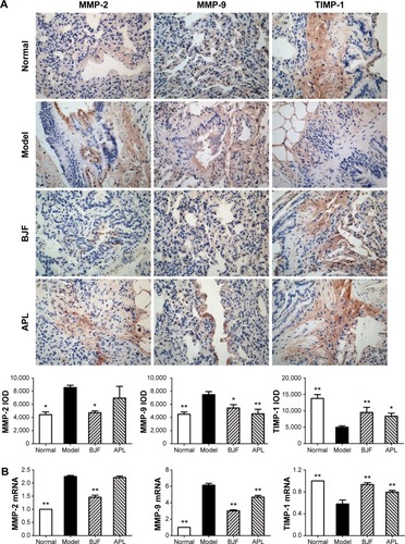 Figure 9 Effect of Bufei Jianpi formula (BJF) and aminophylline (APL) on the expression of matrix metalloproteinase (MMP)-2, MMP-9, and tissue inhibitor of MMP (TIMP)-1 in the lung obtained from chronic obstructive pulmonary disease (COPD) rats.Notes: Immunohistochemical and quantitative analysis for the expression of MMP-2, MMP-9, and TIMP-1 in the lung of COPD rats (original magnification ×200) (A). The messenger RNA (mRNA) levels of MMP-2, MMP-9, and TIMP-1 were analyzed with reverse transcriptase-polymerase chain reaction (B). Data are presented as mean ± standard error of mean. *P<0.05, **P<0.01 vs model.Abbreviation: IOD, integral optical density.