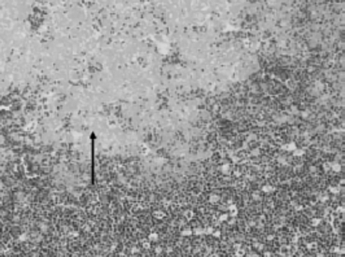 Figure 4.  Histological section of the spleen of an Amazon parrot with multifocal severe necrosis (arrow tip) with little mononuclear infiltration. Haematoxylin and eosin, ×100.