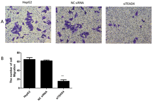 Figure 6 Transwell assay detected the invasive effect of TEAD4 gene on HepG2 cells.