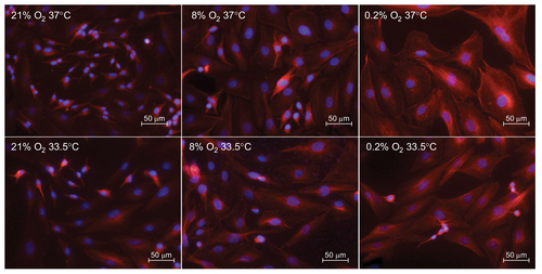 Figure 4 Cell morphology after 24 hours of atmospheric normoxia, subatmospheric oxygen tension, or hypoxia (21%, 8%, or 0.2% O2) followed by 72 hours of normothermia (37°C) or hypothermia (33.5°C). SK-N-SH cells are stained with anti-beta III-Tubulin (red) and DAPI (blue).