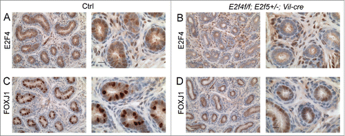 Figure 3. Expression of a multiciliated cell marker, FOXJ1 is reduced early during efferent duct development. Immunohistochemical staining for E2F4 or FOXJ1 (brown stains) in efferent ducts from one week old littermates. (A) Control efferent ducts (Ctrl) showing nuclear expression of E2F4 and (B) the loss of E2F4 from E2f4f/f;E2f5+/−;Vil-cre efferent duct epithelium at this stage. Note that mesenchymal expression of E2F4 is not lost in the mutants. (C) Robust expression of FOXJ1 in the controls in comparison with weak expression in the mutants (D). Scale bars: for each set, left hand panel 20 μm and the right hand panel 10 μm.