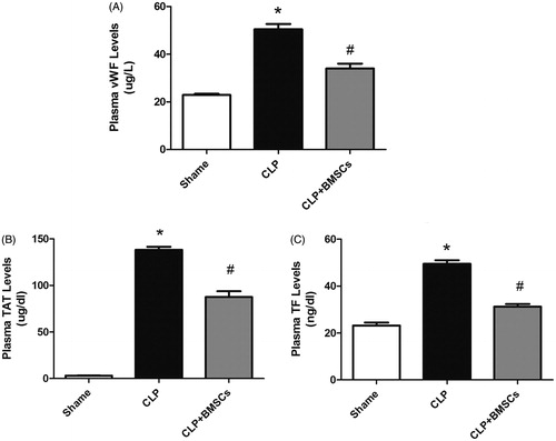 Figure 5. Plasma levels of vWF, TAT, and TF in the three groups were measured by enzyme-linked immunosorbent assay (ELISA) (n = 4–8, per group): (A) vWF, (B) TAT, and (C) TF. Data are expressed as mean ± SEM, and were compared by one-way ANOVA and SNK method; *p < 0.05 versus the sham group; #p < 0.05 versus the CLP control group. ANOVA: Analysis of Variance; CLP: cecal ligation and puncture; SEM: standard error of the mean; SNK: Student–Newman–Keuls.