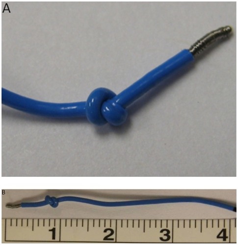 Figure 1 Knotted stimulating femoral nerve catheter following its removal using saline expansion beneath the fascia iliaca. (A) A close-up of the stimulating knotted catheter. (B) The knot is located less than 1 cm from the tip of the catheter. Notice how the catheter is shorter than its original length; the black mark resembles 5 cm in an unknotted catheter.