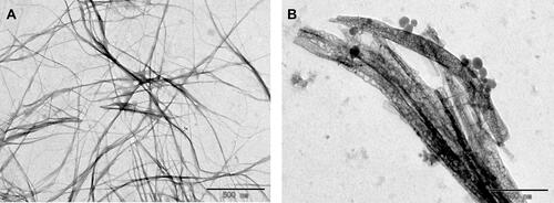 Figure 6 Transmission electron microscopy (TEM) micrographs of the FFYEE fibers (A) and D-gal-FFYEE-hyd-DOX fibers (B).