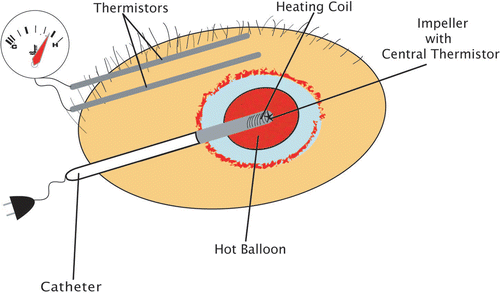 Figure 3. Sketch of a hot balloon as it lies inside the mammary gland.