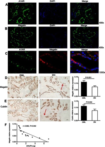 Figure 3 A1 adenosine receptor (A1AR) deletion aggravated renal tubular microvilli, megalin-cubillin loss, and albuminuria in DN mice. (A and B) Transmission electron microscope showed shortened length and reduced density tubular microvilli in DN mice compared to control mice, further shorter and more sparse density were observed in KO-DN mice than WT-DN mice. (A: Original magnification =10,000×. Bar width =1 μm; B: Original magnification =25,000×. Bar width =500 nm). (C and D). Immunohistochemical staining showed both megalin (C) and cubilin (D) expression decreased sequentially in WT-control, WT-DN, and A1AR knock out (KO)-DN mice at 4 weeks (100× magnification). (E) Semiquantitative analysis confirmed that down-regulation of megalin and cubilin expression was significant. (F) Compared to WT-DN, A1AR deletion aggravated urine albumin excretion (UAE) in KO-DN. (G). Level of UAE was negatively correlated with megalin (black dotted line) and cubilin (red solid line) relative expression. Red arrows in panels B showed microvilli of proximal tubular brush border. Black arrows in panels C and D showed megalin loss area of diabetes mice. Data were analyzed by the positive area proportion of megalin and cubilin at proximal tubules, and data were presented as mean ± SEM (N=6 per group). Bar width =100px.