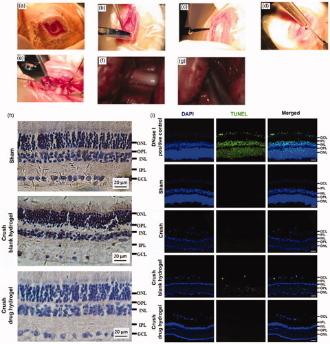 Figure 5. The surgical procedure to expose the optic nerve (a-f) and crush of optic nerve by reverse artery clamp (g). The H&E (h) and TUNEL (i, scale bar 20 μm) staining of retina from rabbits.