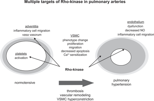 Figure 2 Schematic illustration of possible Rho-kinase mediated pathophysiological mechanisms that may contribute to the development of pulmonary hypertension.