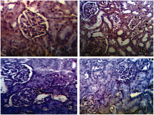 Figure 5. The expression of IL-1 in the glomeruli of kidney tissues of different groups is represented. (a) Expression of IL-1 in glomeruli of control rat kidney. (b) Expression of IL-1 in diabetic rat kidney. (c) Expression of Il-1 in naringenin (5 mg/kg) treated diabetic rat kidney. (d) Expression of IL-1 in naringenin (10 mg/kg) treated diabetic rat kidney. Arrow represents the expression of IL-1 in glomeruli of kidney. Arrows indicate the immunopositive cells. dt, distal tubule (H&E × 100; scale bars = 50 μm).