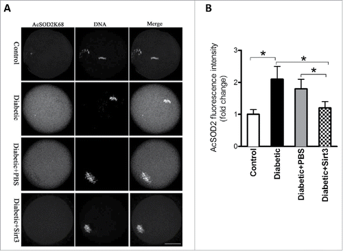 Figure 4. Sirt3 overexpression lowers the acetylation levels of SOD2K68 in oocytes from diabetic mice. Control (n = 77), diabetic (n = 71), diabetic+PBS (n = 80) and diabetic+Sirt3 (n = 76) MII oocytes were labeled with acetyl-SOD2K68 antibody and counterstained with Hoechst 33342 for chromosomes. (A) Representative images show the AcSOD2K68 signal and DNA in oocytes. Scale bar: 25 μm. (B) Quantitative analysis of fluorescence intensity shown in A. Data were expressed as mean ± SD from 3 independent experiments. *p < 0.05 vs control.